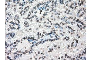 Image no. 2 for anti-B-Raf proto-oncogene, serine/threonine kinase (BRAF) antibody (ABIN1496951) (BRAF 抗体)