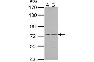 WB Image Sample (30 ug of whole cell lysate) A: NIH-3T3 B: JC 7. (PRKG1 抗体  (Center))