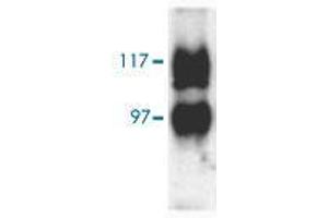 Western blot analysis of Slc14a2 in rat kidney (inner medulla) with Slc14a2 polyclonal antibody  at 1:1000 dilution. (Solute Carrier Family 14 (Urea Transporter, Kidney) Member 2 (SLC14A2) (AA 911-929) 抗体)
