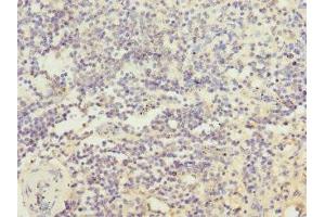 Immunohistochemistry of paraffin-embedded human spleen tissue using ABIN7156852 at dilution of 1:100 (IL21 Receptor 抗体  (AA 20-240))