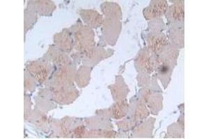 Detection of IL24 in Rat Skin Muscle Tissue using Monoclonal Antibody to Interleukin 24 (IL24) (IL-24 抗体  (AA 29-183))