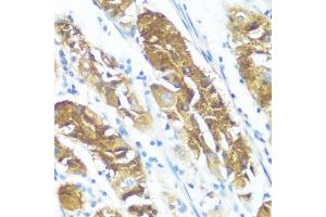 Immunohistochemistry of paraffin-embedded human stomach using NME3 antibody (ABIN3016659, ABIN3016660, ABIN3016661 and ABIN6219806) at dilution of 1:100 (40x lens). (NME3 抗体  (AA 20-169))