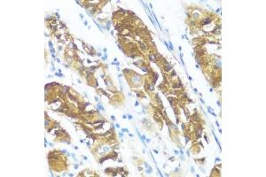 Immunohistochemistry of paraffin-embedded human stomach using NME3 antibody (ABIN3016659, ABIN3016660, ABIN3016661 and ABIN6219806) at dilution of 1:100 (40x lens).