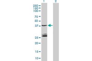 Western Blot analysis of STK19 expression in transfected 293T cell line by STK19 MaxPab polyclonal antibody. (STK19 抗体  (AA 1-364))