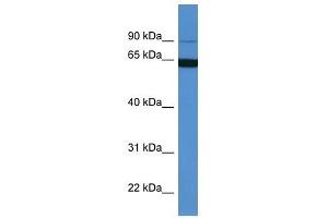 Western Blot showing MAP6 antibody used at a concentration of 1-2 ug/ml to detect its target protein. (MAP6 抗体  (N-Term))