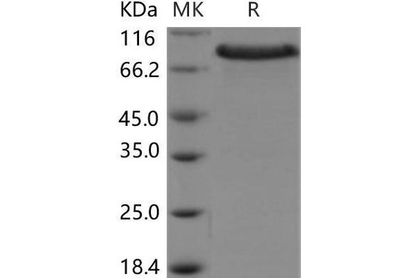 CRELD1 Protein (Fc Tag,ECD)