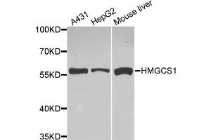 Western Blotting (WB) image for anti-3-Hydroxy-3-Methylglutaryl-CoA Synthase 1 (Soluble) (HMGCS1) (AA 241-520) antibody (ABIN6220423) (HMGCS1 抗体  (AA 241-520))