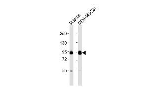 All lanes : Anti-EZH2 Antibody at 1:2000 dilution Lane 1: mouse testis lysates Lane 2: MDA-MB-231 whole cell lysates Lysates/proteins at 20 μg per lane. (EZH2 抗体  (N-Term))