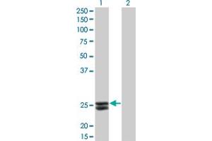Western Blot analysis of PRL expression in transfected 293T cell line by PRL monoclonal antibody (M02), clone 1E1. (Prolactin 抗体  (AA 29-227))