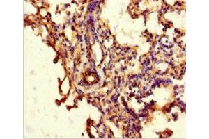 Immunohistochemistry of paraffin-embedded human lung tissue using ABIN7144942 at dilution of 1:100 (ABCG8 抗体  (AA 176-413))