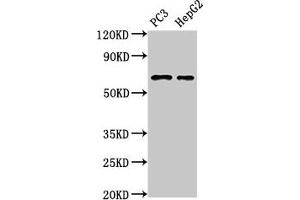 Western Blot Positive WB detected in: PC-3 whole cell lysate, HepG2 whole cell lysate All lanes: PARP2 antibody at 3 μg/mL Secondary Goat polyclonal to rabbit IgG at 1/50000 dilution Predicted band size: 67, 65 kDa Observed band size: 67 kDa (PARP2 抗体  (AA 14-149))