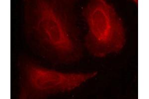 Immunofluorescence staining of methanol-fixed Hela cells using PDK1(Phospho-Ser241) Antibody. (PDPK1 抗体  (pSer241))
