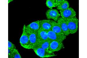 HepG2 cells were fixed with paraformaldehyde, permeabilized with 0. (Peroxiredoxin 1 抗体)