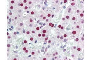 Anti-DDB1 antibody IHC of human adrenal. (DDB1 抗体)