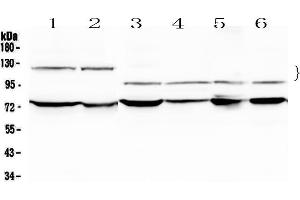Western blot analysis of NFATC4 using anti-NFATC4 antibody .