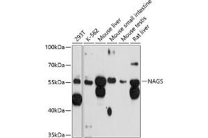 Western blot analysis of extracts of various cell lines, using NAGS antibody (ABIN6130570, ABIN6144346, ABIN6144347 and ABIN6215659) at 1:3000 dilution. (NAGS 抗体  (AA 295-534))
