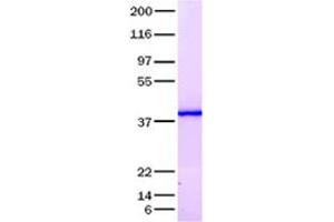 Validation with Western Blot (IL17D 蛋白)