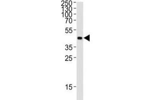 Western blot analysis of lysate from 12 tag recombinant protein (41 kDa) using GST Tag antibody at 1:1000. (GST-Tag 抗体)