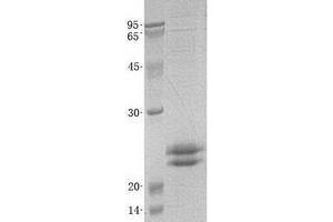 Validation with Western Blot (VMO1 Protein (Transcript Variant 3) (His tag))