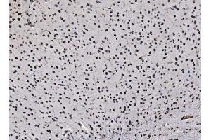 IHC analysis of DBC-1/CCAR2 using anti-DBC-1/CCAR2 antibody (ABIN7602235). (CCAR2 抗体  (AA 65-917))