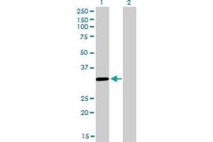 Western Blot analysis of ZNF346 expression in transfected 293T cell line by ZNF346 monoclonal antibody (M01), clone 2D10. (ZNF346 抗体  (AA 133-232))