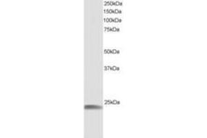 Image no. 1 for anti-Heat Shock 22kDa Protein 8 (HSPB8) (AA 184-196) antibody (ABIN292049) (HSPB8 抗体  (AA 184-196))