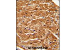 FGF7 antibody immunohistochemistry analysis in formalin fixed and paraffin embedded human M. (FGF7 抗体  (AA 57-86))