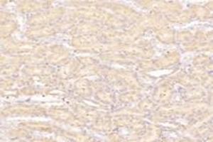Immunohistochemistry (Paraffin-embedded Sections) (IHC (p)) image for anti-Prostaglandin F Receptor (FP) (PTGFR) antibody (ABIN7075209)