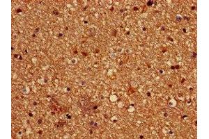 Immunohistochemistry of paraffin-embedded human brain tissue using ABIN7162619 at dilution of 1:100 (Paralemmin 抗体  (AA 1-384))