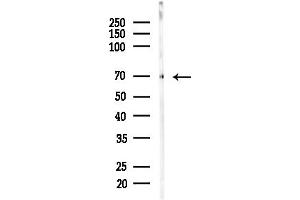Western blot analysis of lysates from HUVEC cells(starvation,24h treatment), using SLCO1 Antibody at 1/1000 dilution.