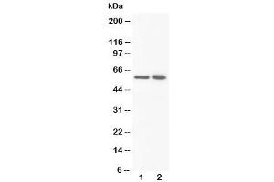 Western blot testing of FMO3 antibody and Lane 1:  rat liver (FMO3 抗体  (N-Term))