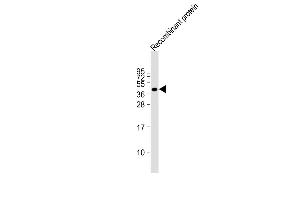 Anti-FAT4 Antibody at 1:2000 dilution + Recombinant protein at 20 ng per lane.