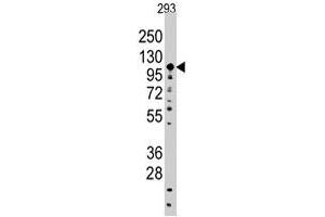 Western blot analysis of SALL4 polyclonal antibody  in 293 cell line lysates (35 ug/lane). (SALL4 抗体  (C-Term))