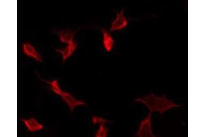 ABIN6268654 staining Hela by IF/ICC. (GJC1 抗体)