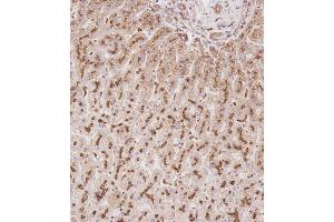 Immunohistochemical analysis of C on paraffin-embedded Human liver tissue. (Glucuronidase beta 抗体  (AA 335-362))