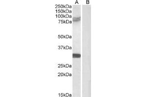 Western Blotting (WB) image for anti-Tripartite Motif Containing 2 (TRIM2) (C-Term) antibody (ABIN184974)