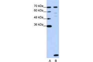 Western Blotting (WB) image for anti-LSM2 Homolog, U6 Small Nuclear RNA Associated (LSM2) antibody (ABIN2462291) (LSM2 抗体)