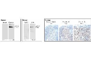 Analysis of Bcl-6 expression by Western blot and Immunohistochemistry. (BCL6 抗体)