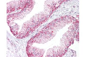 Anti-AURKA / Aurora-A antibody IHC of human prostate. (Aurora A 抗体  (C-Term))