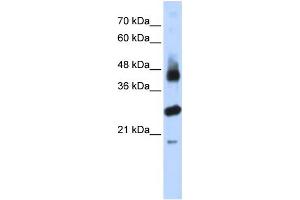 WB Suggested Anti-FBXL2 Antibody Titration:  0. (FBXL2 抗体  (N-Term))