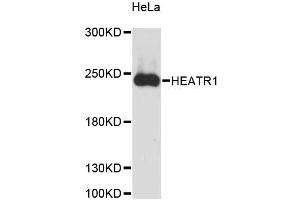 Western blot analysis of extracts of HeLa cells, using HEATR1 antibody. (HEATR1 抗体)