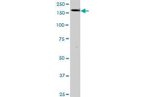 Western Blotting (WB) image for anti-TEK Tyrosine Kinase, Endothelial (TEK) (AA 66-185) antibody (ABIN793004) (TEK 抗体  (AA 66-185))