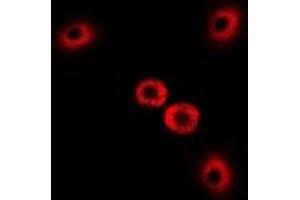 Immunofluorescent analysis of Myosin Ic staining in U2OS cells. (Myosin IC 抗体)