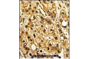 Immunohistochemistry (Paraffin-embedded Sections) (IHC (p)) image for anti-Integrin, alpha X (Complement Component 3 Receptor 4 Subunit) (ITGAX) (AA 1119-1145), (C-Term) antibody (ABIN390974)