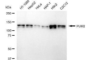 Western blotting analysis using PUM2 antibody (ABIN7800065).