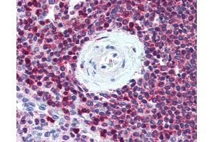 Anti-SLC9A3R1 / NHERF1 antibody IHC of human spleen. (SLC9A3R1 抗体)