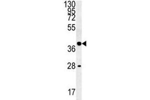 WNT8B antibody western blot analysis in K562 lysate (WNT8B 抗体  (AA 323-351))