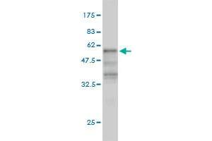 Western Blot detection against Immunogen (54. (KLF6 抗体  (AA 1-260))