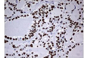 Image no. 1 for anti-Nibrin (NBN) (AA 183-460) antibody (ABIN1491059) (Nibrin 抗体  (AA 183-460))