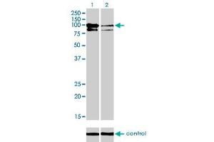 Western blot analysis of OCRL over-expressed 293 cell line, cotransfected with OCRL Validated Chimera RNAi (Lane 2) or non-transfected control (Lane 1). (OCRL 抗体  (AA 146-239))